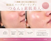 シュエット(Chouette)