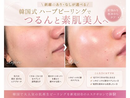 シュエット(Chouette)の写真