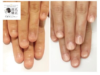 トイロ(toiro)/自爪のような自然な長さだし