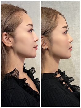 メディカルエース(MedicalAce)/看護師ハイサーマ