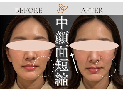 チョコバリ 新宿店(chocobari)の写真