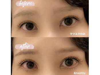 コクシネル(coccinelle)/超話題!アンドヘルシーとは?