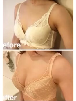 スマイルクルー(SmileClue)/ビフォーアフター症例