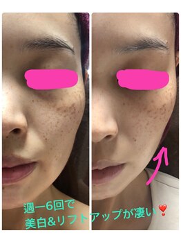 ビオナス(BIONAZ)/ララピール凄い!3