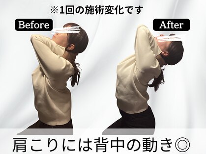 ハリユナイテッド 原宿鍼灸 整体院(HALI UNITED)の写真