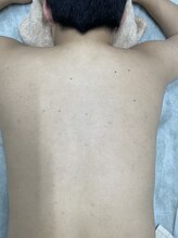 ナノハナ/鹿沼市の全身脱毛のナノハナ