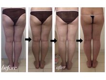 美人バスト 札幌店/ダイエット◇症例◇バストアップ