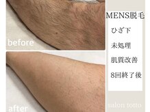 サロントット(salon totto)/before→after