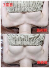 ビープラス(B+)/上:before 　下:after