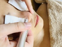 アール(R)/４　吸引