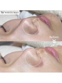 ホワイトワックス 浜松(WHITE WAX)/潤艶肌への近道◎