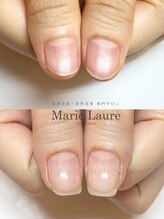 マリーロール 淀屋橋本店(Marie Laure)/自爪育成/深爪矯正/ネイルケア