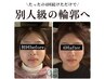 小顔頭蓋骨矯正＋リンパケア4回コース￥61,600→￥41,600 所用時間60分