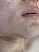 ラブ アンド ピース(Love&Peace)