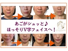 シェノン(CHAINON)