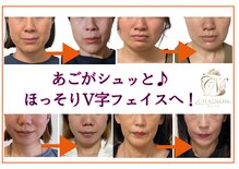 シェノン(CHAINON)