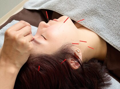 Re:treat HARi 大阪梅田院【鍼灸/ヘッドスパ/オイルマッサージ】【リトリートハリ】の写真