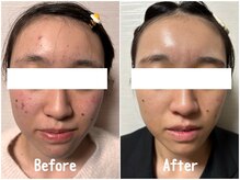 ブレス/Before→After