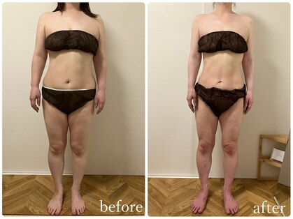 リリィブラン(Lily branc)の写真