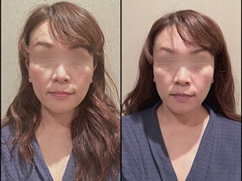 ラースパ アザブ(La SPA azabu)/La SPA麻布小顔ドライヘッドスパ