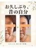 【たるみ・小顔】フェイスライン＆横顔すっきり　60分 初回￥7,980