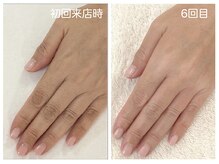キレイテ 上野店/40代/6回目【ハンドケア稲荷町】