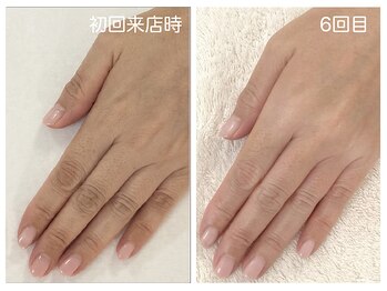 キレイテ 上野店/40代/6回目【ハンドケア稲荷町】