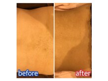 ウルル 四日市駅前店(ULULU)/施術前と施術後