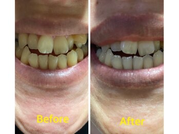 サロン ド アール/セルフホワイトニング