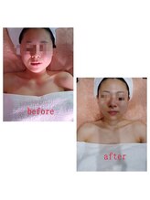 ウーマンズデザイン(WOMAN's DESIGN)/美肌と小顔　ビフォーアフター