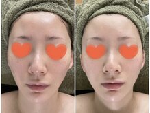 ビーナイス ビューティー(Be Nice Beauty)/