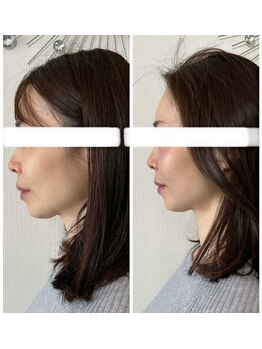 メディカルエース(MedicalAce)/看護師ハイサーマ