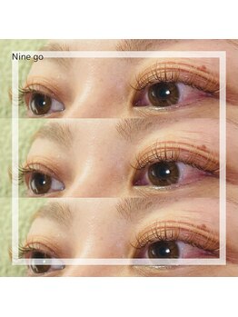 ナイン ゴー(Nine go)/バインドロック