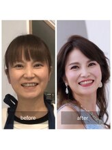 ハッピーアリスター(HAPPY ALISTER)/特別な日のステージメイク☆