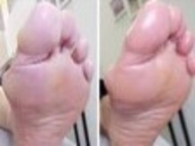 リゼラアンドコー 船橋店/ドイツ式フットケア専門店