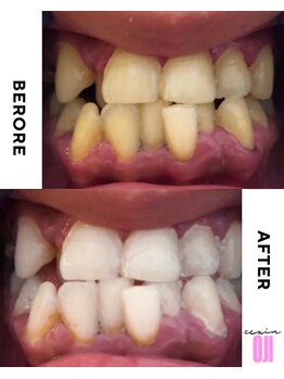 エクシアホワイトニング 王寺店/