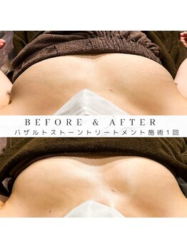 マタタビ(mata-tabi)/