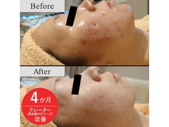 メディカルフェイシャルエステティック サロン ド ヴェリテ(VERITE)/