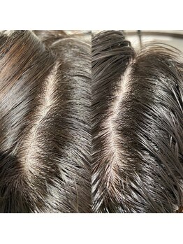 シュール センター南(SURREAL)/ヘッドスパ後のビフォーアフター