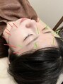 整骨院 アンド パーソナルジム コニー 美容鍼ならお任せください♪
