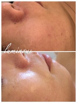 ルミナス(luminous)/【ハーブエステ】グリーンピール