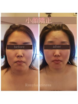 ロージーハピネス(Rosy happiness)/小顔になりたい方