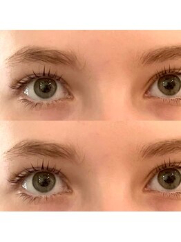 ウルム(ulm)/上下ラッシュリフト