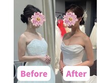 ボディキュア ブライダル美容整体 大阪梅田/【デコルテ×肩】華奢見え成功