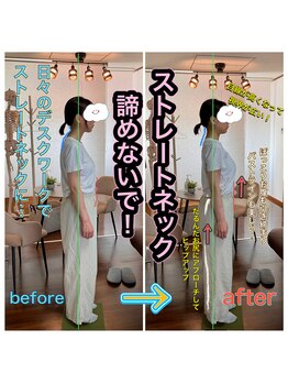 整体院ヒカリノキュウジツ さくら店/症例紹介★姿勢改善
