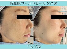 リメイククリニカルビューティー(Remake clinical beauty)/