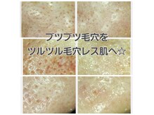 サロン ド ボーテ プルーラ(Salon de beaute PLURA)