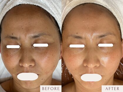 クラームビューティー(Clerm beauty)の写真