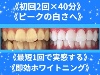 ホワイトニングショップ 四条店