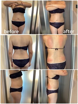 アリス 赤坂/上半身スペシャル8カップ 5回